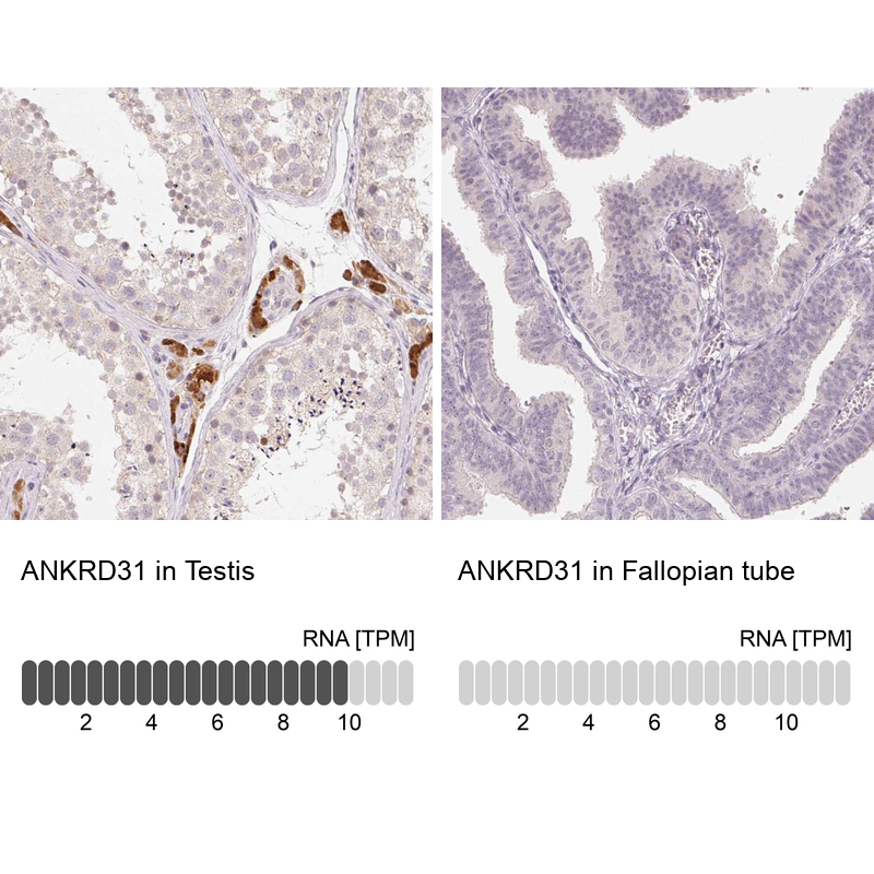 Anti-ANKRD31 Antibody