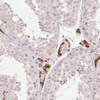 Immunohistochemical staining of human testis shows high expression.