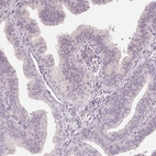 Immunohistochemical staining of human fallopian tube shows low expression as expected.