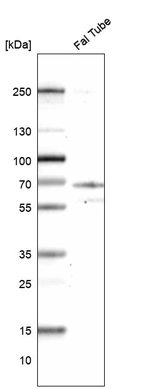 Anti-CCDC65 Antibody