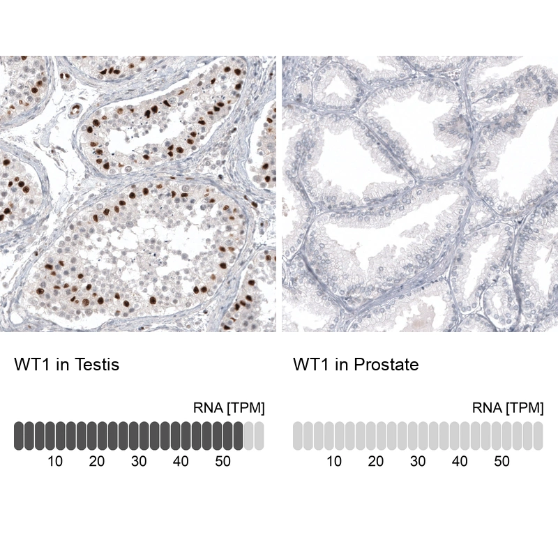 Mouse Monoclonal Anti-WT1 Antibody - Buy for research - Highly specific ...