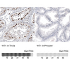 Anti-WT1 Antibody