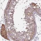 Anti-ZFYVE28 Antibody