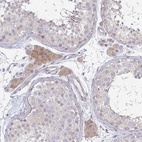 Anti-C10orf90 Antibody