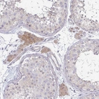 Anti-C10orf90 Antibody
