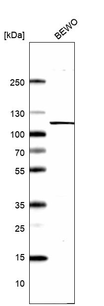 Anti-XPOT Antibody