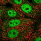 Immunofluorescent staining of human cell line MCF7 shows localization to nucleoplasm & cytosol.