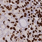 Anti-MON2 Antibody