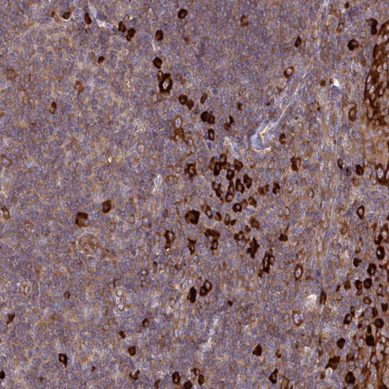 Anti-YARS2 Antibody