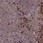 Anti-YARS2 Antibody