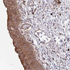 Immunohistochemical staining of human urinary bladder shows moderate cytoplasmic positivity in urothelial cells.