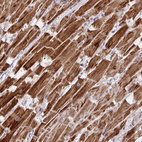 Immunohistochemical staining of human heart muscle shows strong cytoplasmic positivity in cardiomyocytes.