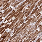 Immunohistochemical staining of human heart muscle shows strong cytoplasmic positivity in cardiomyocytes.