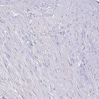 Immunohistochemical staining of human prostate shows no positivity in smooth muscle cells as expected.