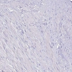 Immunohistochemical staining of human prostate shows no positivity in smooth muscle cells as expected.