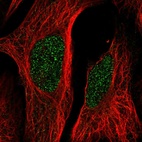 Anti-LCOR Antibody