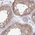 Anti-TRIM44 Antibody