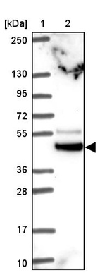 Lane 1: Marker [kDa] 250, 130, 95, 72, 55, 36, 28, 17, 10_br/_Lane 2: Human cell line RT-4
