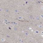 Immunohistochemical staining of human cerebral cortex shows high expression.