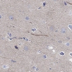 Immunohistochemical staining of human cerebral cortex shows high expression.