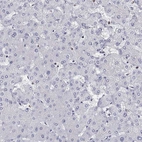 Immunohistochemical staining of human liver shows low expression as expected.