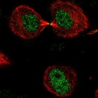 Anti-DNHD1 Antibody