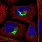 Immunofluorescent staining of human cell line U-2 OS shows localization to intermediate filaments.