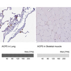 Anti-ACP5 Antibody