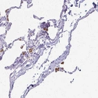 Immunohistochemical staining of human lung shows strong granular cytoplasmic positivity in macrophages.