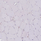 Immunohistochemical staining of human skeletal muscle shows no positivity in myocytes as expected.