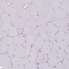 Anti-ACP5 Antibody