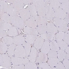 Immunohistochemical staining of human skeletal muscle shows no positivity in myocytes as expected.