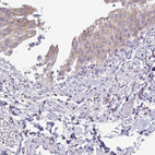 Immunohistochemical staining of human urinary bladder shows moderate granular cytoplasmic positivity in in urothelial cells.