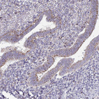 Immunohistochemical staining of human endometrium shows moderate granular cytoplasmic positivity in in glandular cells.