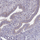 Anti-VPS4B Antibody