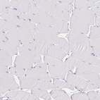 Immunohistochemical staining of human skeletal muscle shows no positivity in myocytes as expected.