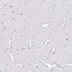 Anti-VPS4B Antibody