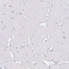 Immunohistochemical staining of human skeletal muscle shows no positivity in myocytes as expected.