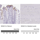 Anti-MS4A12 Antibody