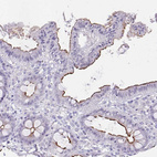 Immunohistochemical staining of human colon shows strong luminal membranous positivity in glandular cells.