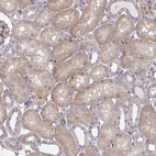 Anti-CEMP1 Antibody