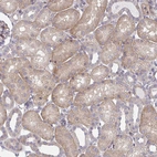 Anti-CEMP1 Antibody