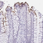 Immunohistochemical staining of human rectum shows strong luminal membranous positivity in glandular cells.