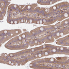 Immunohistochemical staining of human small intestine shows moderate cytoplasmic positivity in glandular cells.
