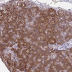 Immunohistochemical staining of human pancreas shows strong cytoplasmic positivity in exocrine glandular cells.