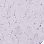 Immunohistochemical staining of human skeletal muscle shows no positivity in myocytes as expected.