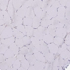 Immunohistochemical staining of human skeletal muscle shows no positivity in myocytes as expected.