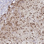 Anti-ACD Antibody