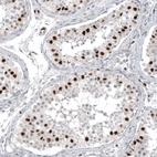 Immunohistochemical staining of human testis shows strong nuclear positivity in cells in seminiferous ducts.