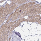 Anti-ZNF805 Antibody